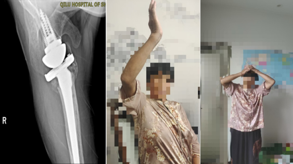 Ninegame九游体育导致右肩要津肿胀、疾苦-九游体育(中国)官方网站 登录入口 IOS/安卓通用版/手机app下载