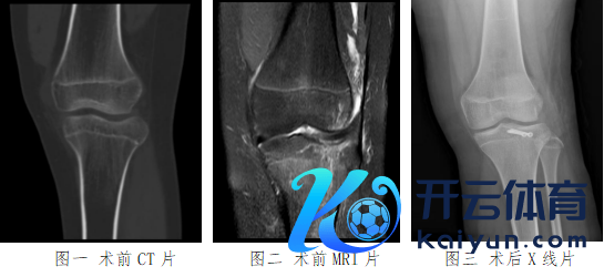 现金九游体育app平台又会酿成要道内较大的毁伤和皮肤瘢痕-九游体育(中国)官方网站 登录入口 IOS/安卓通用版/手机app下载